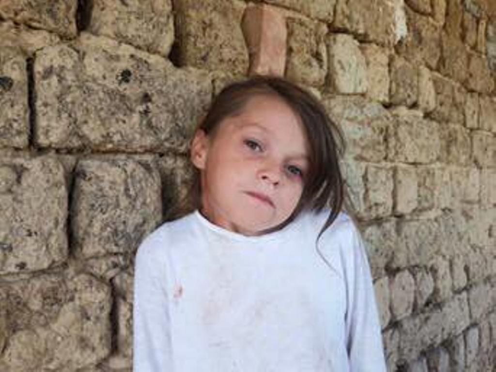 CAMILA INAINTE DE OPERATIA PRIN CARE A FOST SALVATA DE LA MOARTE